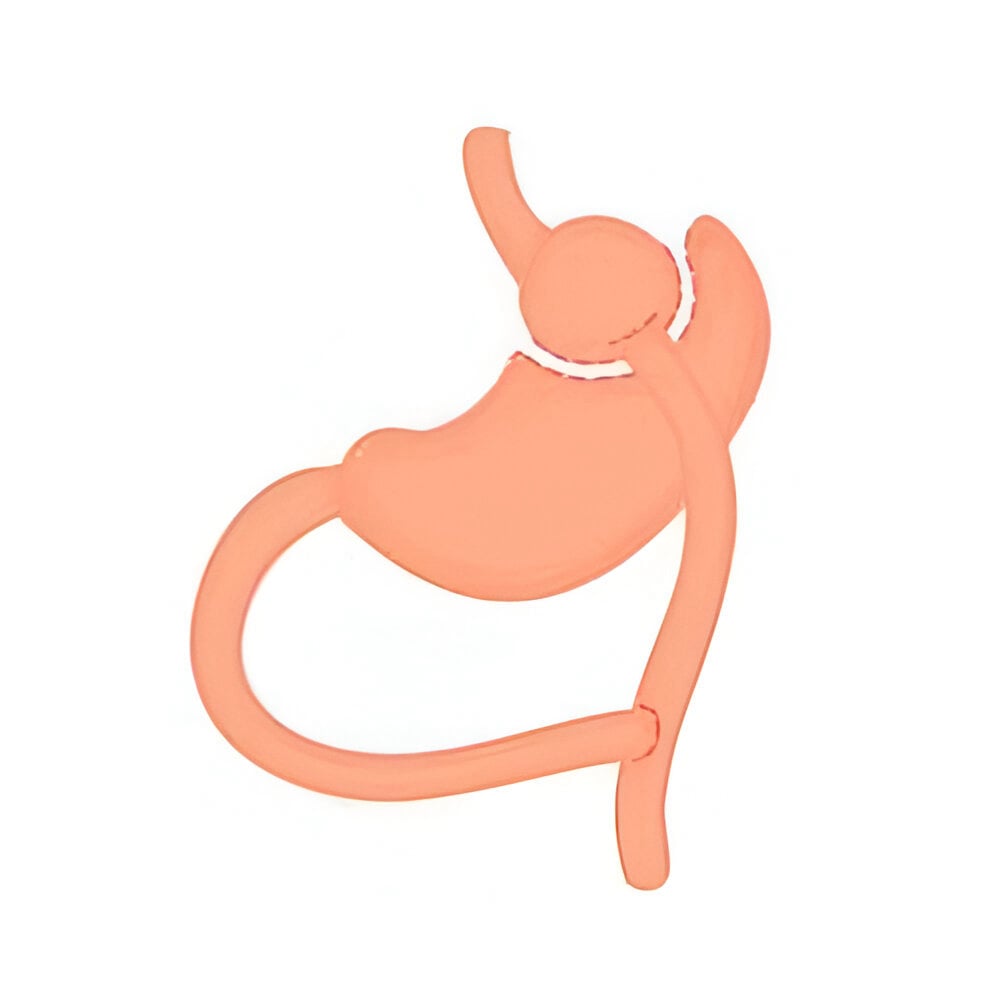 bypass gastrico en guadalajara