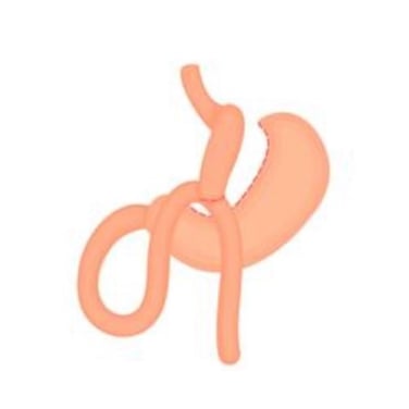 mini bypass gastrico en guadalajara